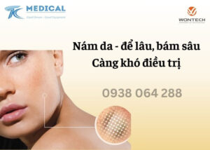 Máy xóa xăm điều trị sắc tố YAG