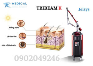 Hiệu quả máy Laser YAG TribeamK