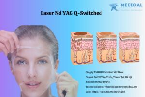 Giới thiệu Laser Nd YAG Q-Switched