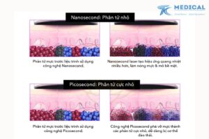 Các loại Laser Nd YAG Q-Switched