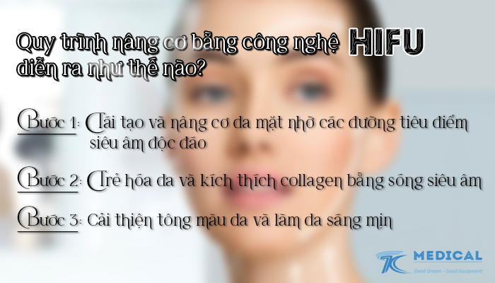 Quy trình thực hiện bằng công nghệ Hifu
