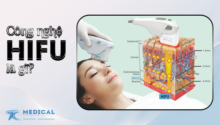 Công nghệ Hifu là gì?