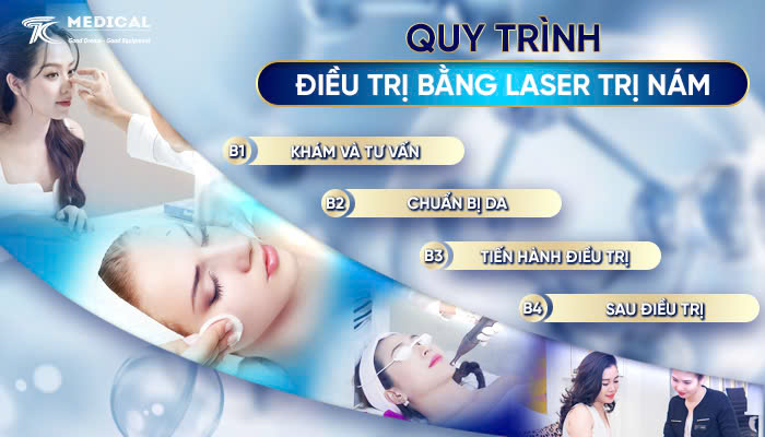 Quy trình điều trị bằng laser trị nám