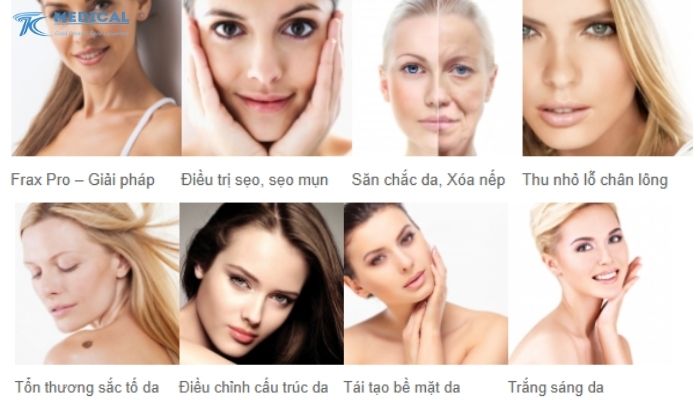 Ưu điểm nổi bật khi sử dụng máy Frax Pro trong cơ sở thẩm mỹ