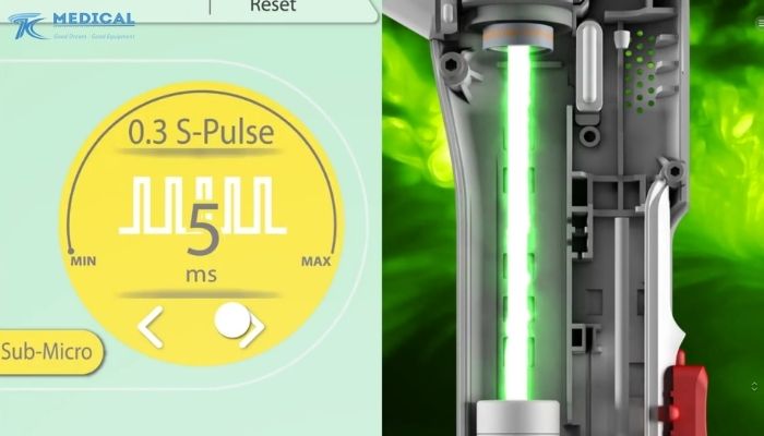 Điểm mạnh của máy laser Derma V