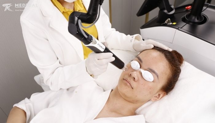 Những lợi ích vượt trội của công nghệ Laser Picolo Premium