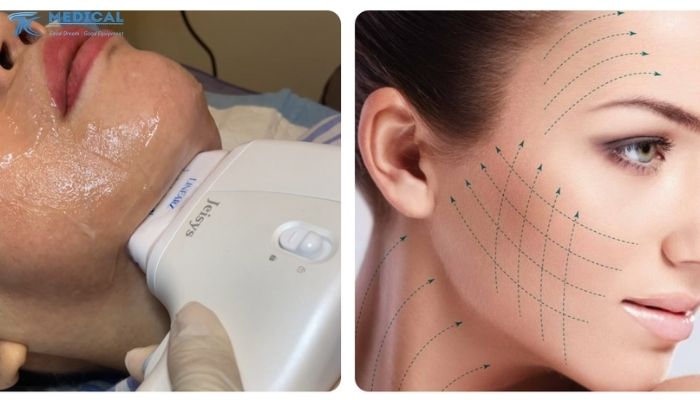 5 cải tiến công nghệ nổi bật chỉ có tại LinearZ