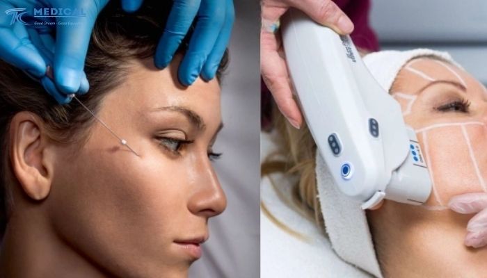 Quy trình HIFU chuẩn (khuyến nghị)