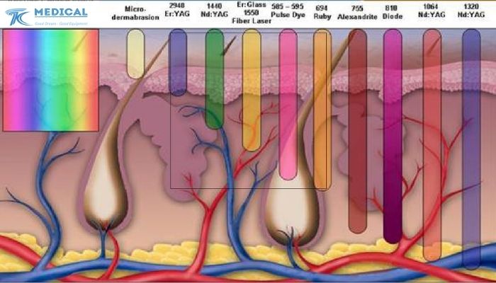 Laser xung dài là gì? Cơ chế tác động sinh học