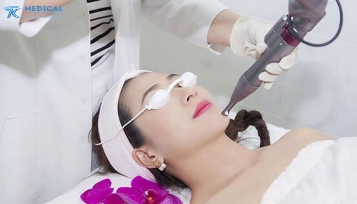 Xu hướng điều trị nám hiện đại và vai trò của laser trị nám