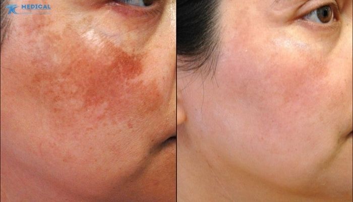 Năng lượng ổn định, hỗ trợ nâng cao hiệu quả điều trị