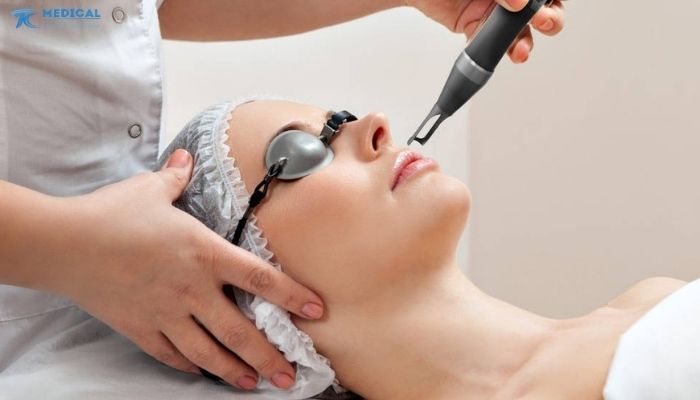 Nám da không còn là vấn đề của riêng phụ nữ trung niên