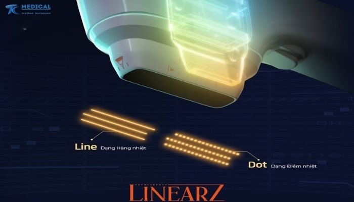 Linear Z Hỗ Trợ Quy Trình Điều Trị Như Thế Nào?