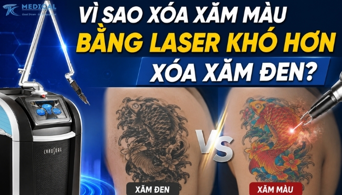 Vì sao hình xăm nhiều màu cần nhiều buổi điều trị hơn?