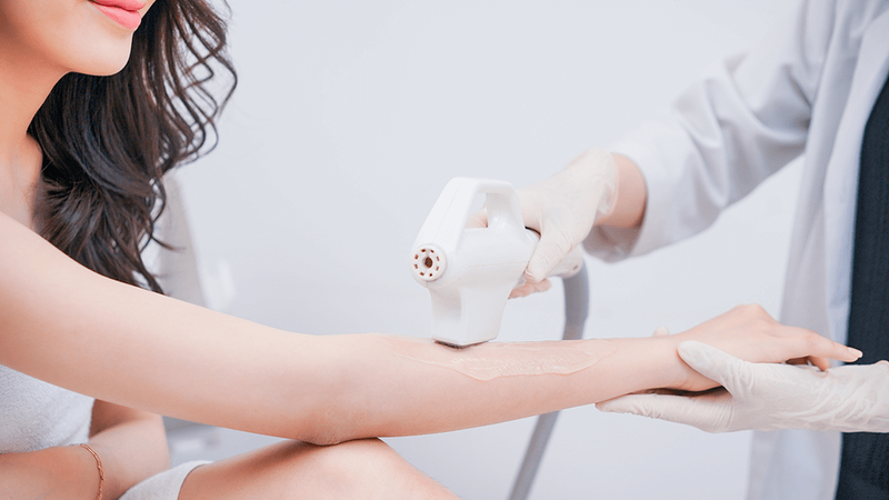 Triệt lông bằng công nghệ DPL