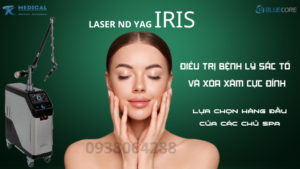 Laser nd YAG IRIS - Lựa chọn hàng đầu về điều trị bệnh lý sắc tố