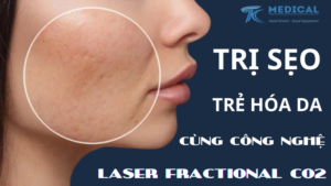 Laser Fractional CO2 điều trị sẹo, trẻ hóa da an toàn hiệu quả