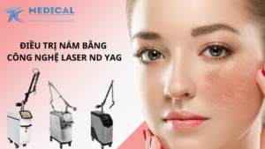 Phương pháp điều trị Nám bằng công nghệ Laser ND YAG