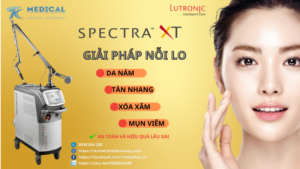 Laser nd YAG Spectra XT điều trị Nám, tàn Nhang, xóa xăm