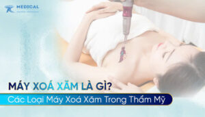 Máy Xoá Xăm Là Gì? Các Loại Máy Xoá Xăm Trong Thẩm Mỹ