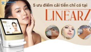 5 ưu điểm cải tiến vượt bậc chỉ có tại Linear Z