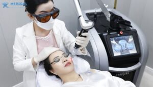 PicoSure và PicoSure Pro ứng dụng trong thẩm mỹ hiện đại